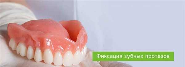 Методы фиксации зубных протезов
