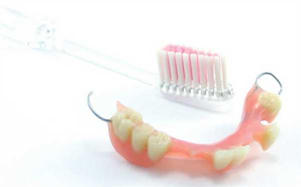 Уход за бюгельным протезом на кламмерах