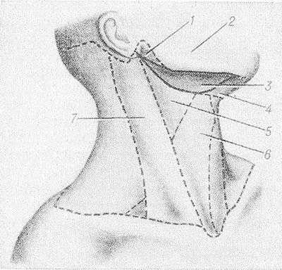 Рис. 1. Схематическое изображение границ подчелюстной области и прилежащих к ней областей шеи: 1 — fossa retromandibularis, 2 — боковая область лица, 3 — подчелюстная область, 4 — trigonum submentale, 5 — сонный треугольник, 6 — лопаточнотрахеальный треугольник, 7 — грудиноключично-сосцевидная область (сплошной линией обозначены границы подчелюстной области, пунктирной линией — области шеи).