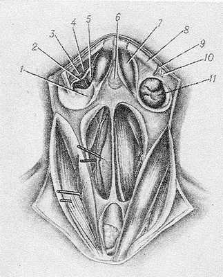 Рис. 2. Схематическое изображение топографии подчелюстной области (голова запрокинута назад, вид спереди): 1 — ложе подчелюстной железы, выстланное поверхностной пластинкой шейной фасции, 2 — v. submentalis, 3 — челюстно-подъязычный нерв, 4 — a. submentalis, 5 — челюстно-подъязычная мышца, 6 — клетчатка trigonum submentale, 7 — переднее брюшко двубрюшной мышцы, 8 —нижняя челюсть, 9 — лицевая артерия, 10 — лицевая вена, 11 — подчелюстная железа.