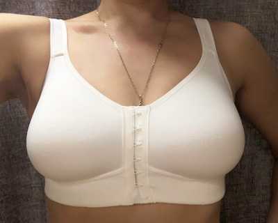 внешняя коррекцию косметического дефекта с помощью облегченного силиконового протеза после мастэктомии и послеоперационного бюстгальтера