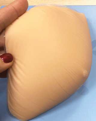 общий обзор текстильных и силиконовых протезов после мастэктомии