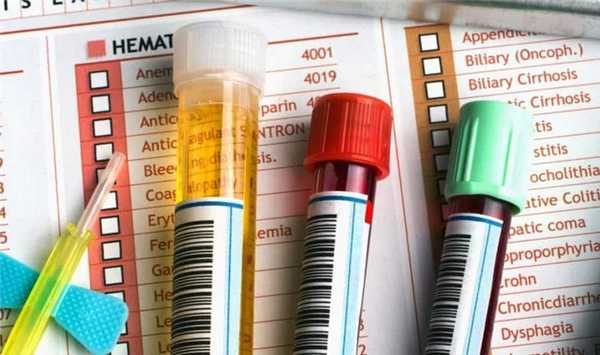 Показатели поджелудочной железы в биохимии, многопрофильная клиника МедПросвет