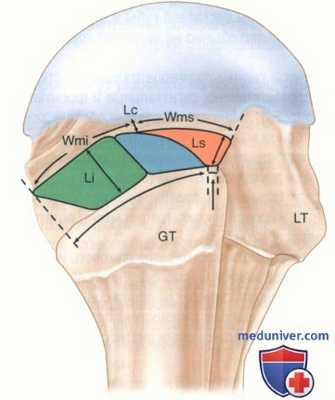 Операция артроскопического шва при массивных разрывах ротаторной манжеты плеча