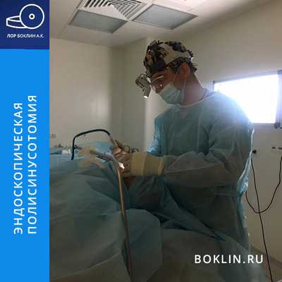 полисинусотомия