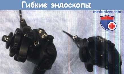 Гибкие эндоскопы