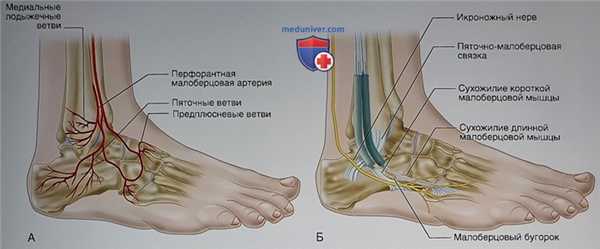 Операция при внутрисуставном переломе пяточной кости