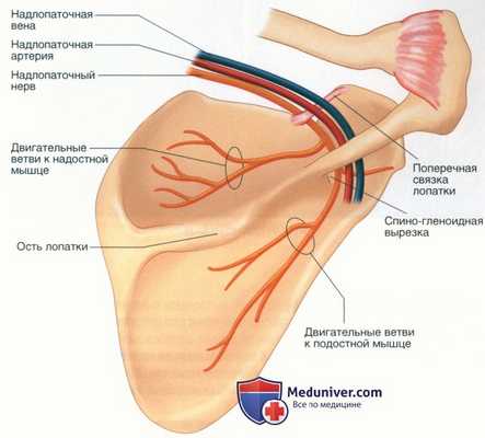 Операция при нейропатии надлопаточного нерва