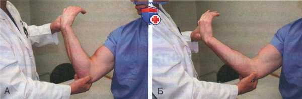 Операция по поводу медиального эпикондилита (локтя гольфиста)