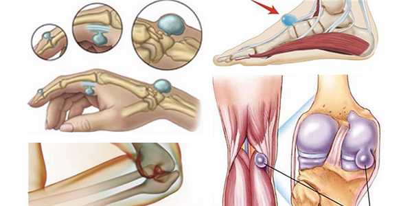Операции на сухожилиях