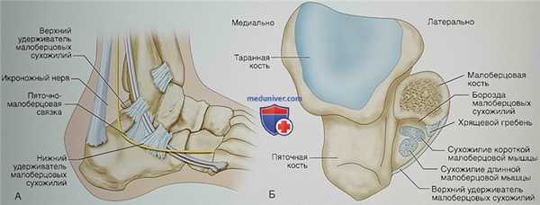Операция при хроническом подвывихе и вывихе малоберцовых сухожилий