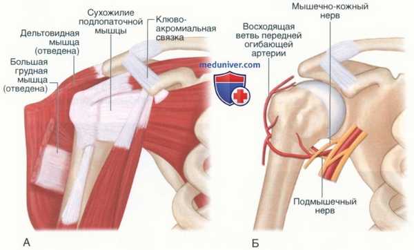 Операция поверхностного эндопротезирования головки плеча