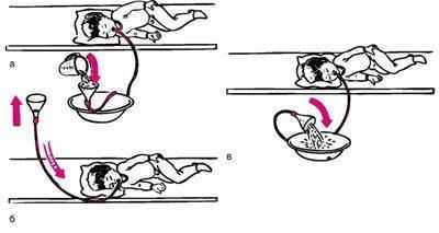 Промывка ЖКТ у ребенка