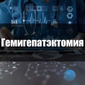 Гемигепатэктомия
