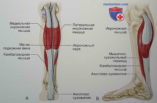Операция релиза икроножной мышцы при эквинусной контрактуре стопы