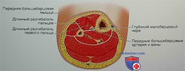 Операция фасциотомия переднего мышечного футляра голени по поводу компартмент-синдрома напряжения
