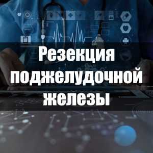 Резекция поджелудочной железы