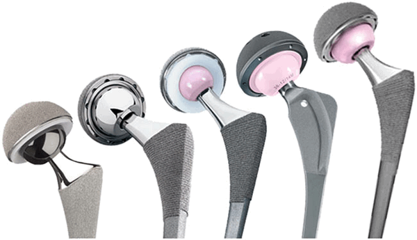 Виды имплантов суставов