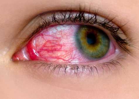 Самый эффективный метод лечения увеита