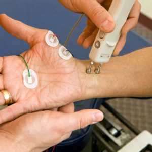 Электромиография (ЭМГ)