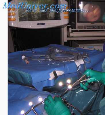 эндоскопическая нейрохирургия