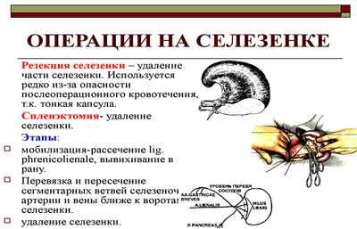 Операции на селезенке