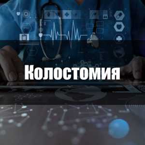 Колостомия