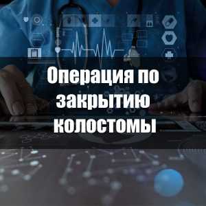 Операция по закрытию колостомы
