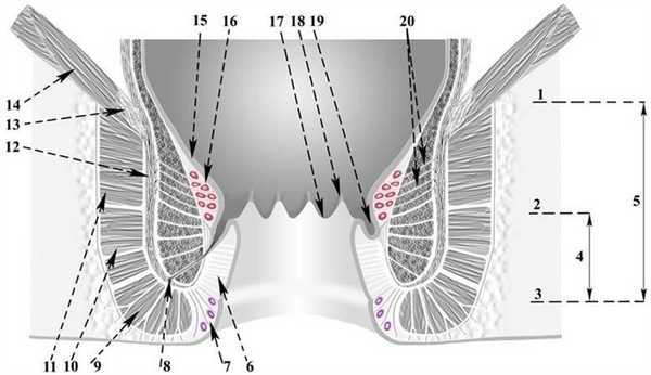 геморроидальные узлы