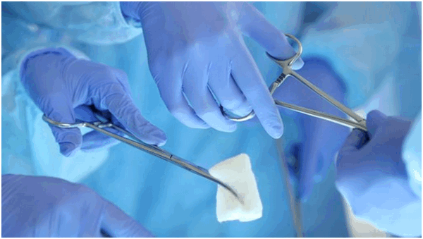 Гемиколэктомия