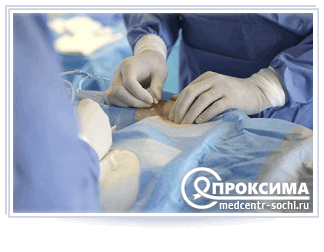 Порядок проведения процедуры