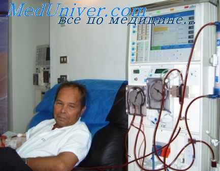 гемодиализ