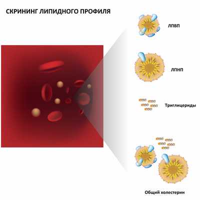 Липидный профиль.jpg