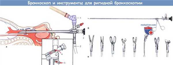 Бронхоскоп и инструменты для ригидной бронхоскопии