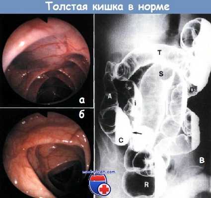 Толстая кишка в норме