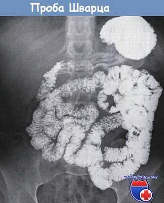 Проба Шварца