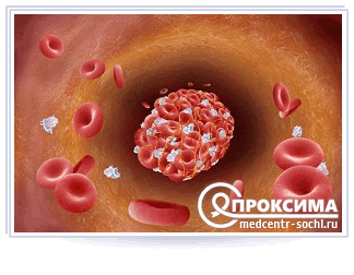 Показания для внутрисуставного введения препарата