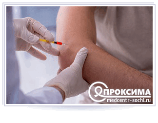 Особенности проведения околосуставных инъекций