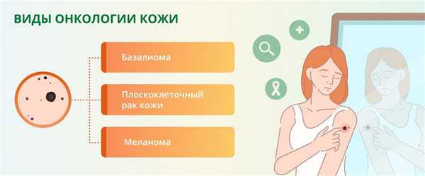Виды онкологии кожи