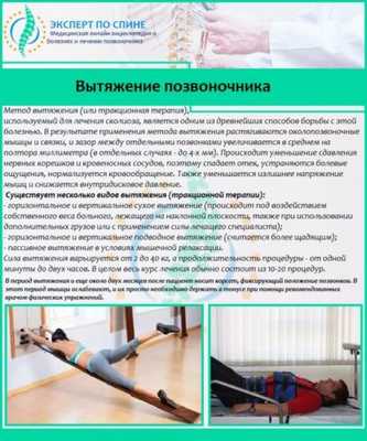 Вытяжение позвоночника