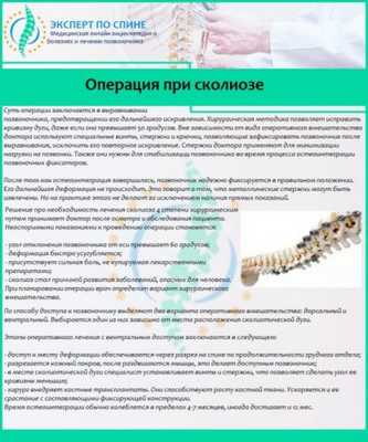 Операция при сколиозе