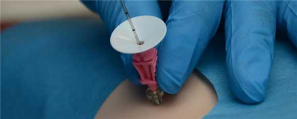 Биопсия и наркоз