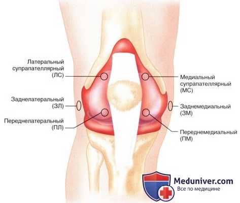 Доступ и техника артроскопической синовэктомии коленного сустава