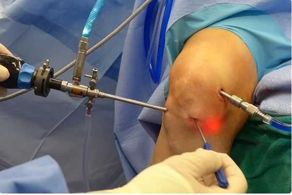 Во время операции.