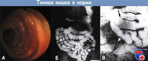 Тонкая кишка в норме