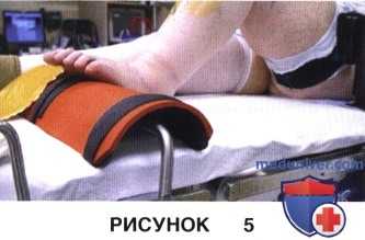 Показания, подготовка к тотальному эндопротезированию коленного сустава