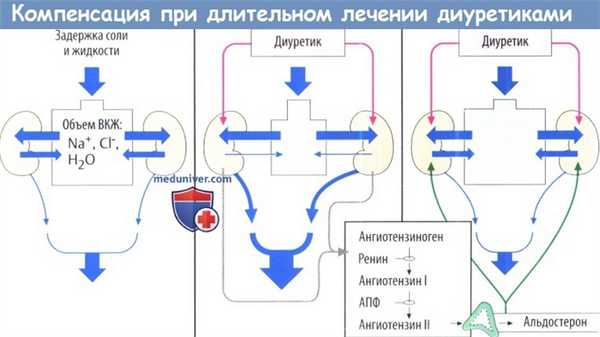 Компенсация при длительном лечении диуретиками