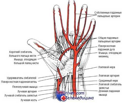 катетеризация периферической артерии у новорожденного