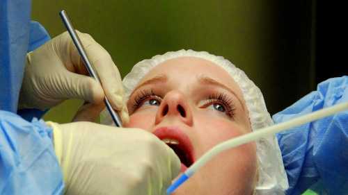 Уздечка языка