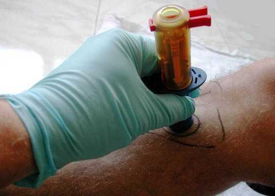 Обеспечение внутрикостного доступа